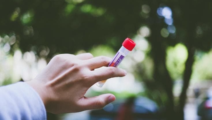 Un test del sangue per scegliere la terapia più efficace contro la depressione resistente