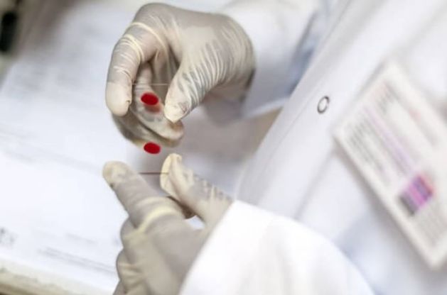 Tumore alla prostata, con una nuova tecnica biopsie a colpo sicuro