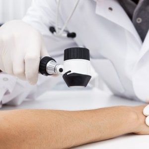 Attacco su tre fronti al melanoma