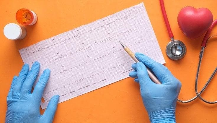 Come rafforzare e salvaguardare il cuore durante la chemioterapia? Esercizio fisico costante? Riposo? Dieta mirata?
