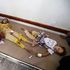 Yemen, almeno 78 bambini sono morti a causa della dengue; si teme un’epidemia nel paese per altri 52mila casi sospetti