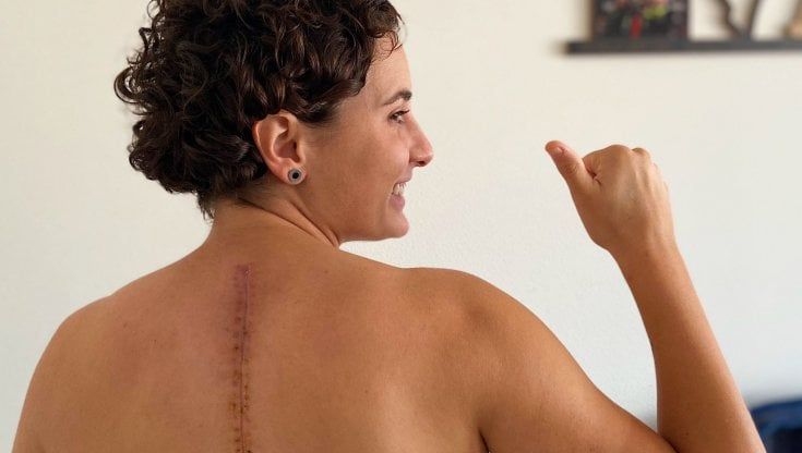 Ana Carrasco: "Quella cicatrice è sparita, la mia vita torna in pista sulla moto"