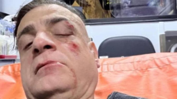 Cicalone pestato in metro: dietro l’agguato c’è il clan Hitler