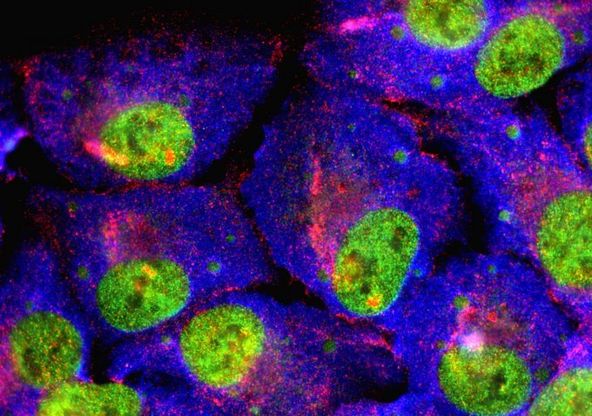 Gli oncologi: "Cambiare il modello di cura dei pazienti guariti da più di 5 anni"