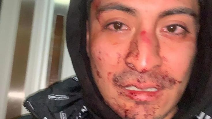 Aggressione omofoba la notte di Capodanno, chiesto il rinvio a giudizio per i tre ventenni