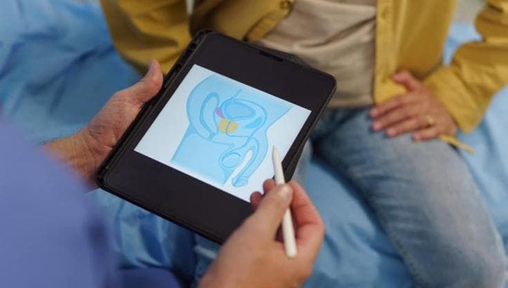 Tumore alla prostata, una nuova terapia riduce del 58% il rischio di metastasi o morte