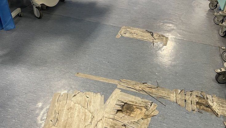 La terapia intensiva cardiologica cade a pezzi, al Civico arrivano i carabinieri