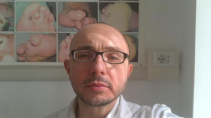 Gaetano Di Stasio: “Ridurre i casi di amputazioni nei diabetici”