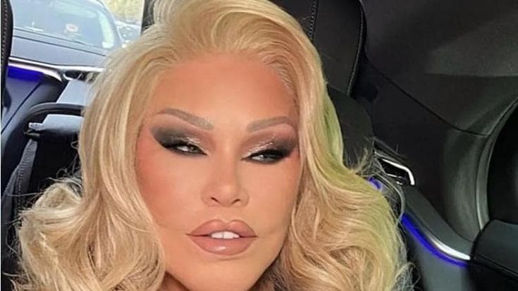 Morta Jocelyn Wildenstein, la “Donna gatto” regina della chirurgia estetica estrema