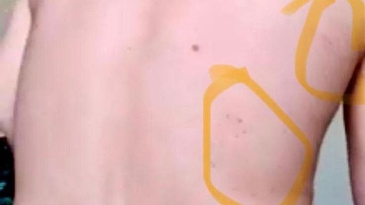 L’ex detenuto a Trapani: “Trattati peggio dei maiali, picchiati senza motivo. Volevano strangolarmi”