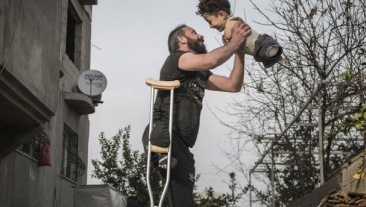Siria, il coraggio di Mustafa: “Sogno di camminare e andare a scuola”