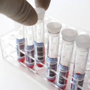 Un farmaco che combatte l'infiammazione. E potrebbe prevenire infarto e cancro