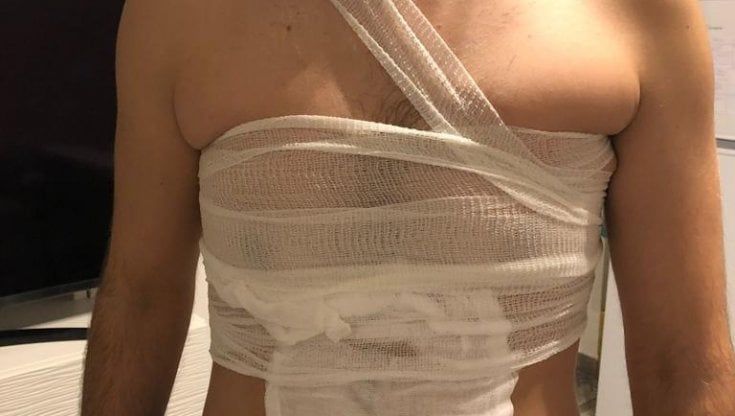 Vallette, agente aggredito con liquido urticante da un detenuto