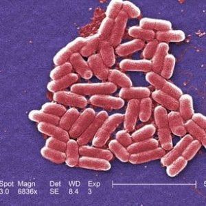 Allarme negli Usa, donna colpita da batterio resistente a tutti gli antibiotici