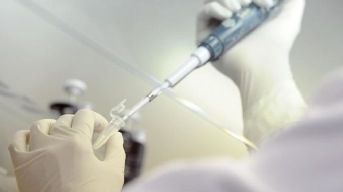 Sla: ricercatori italiani 'a caccia' del Dna malato, scoperto un nuovo gene