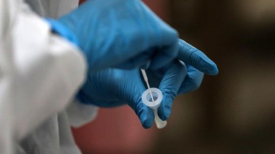 Covid, in 12 minuti test segnala carica virale e anticorpi