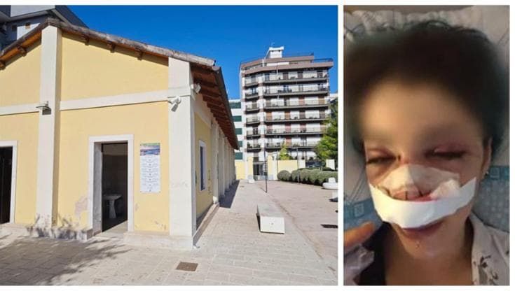 Aggressione Giuditta D’Elia nel parco Rossani: arrestata l’addetta ai bagni. Altre 4 donne indagate