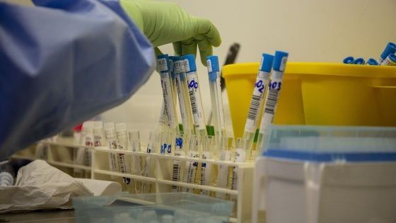 Coronavirus, in Sicilia solo 19 positivi in più, focolaio in un ospizio a Caltagirone