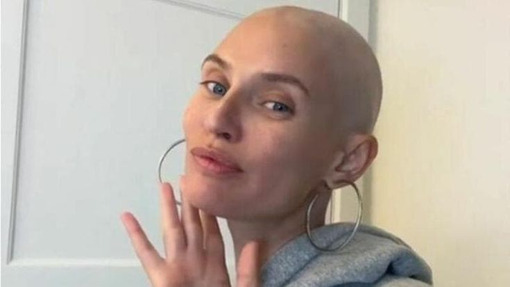 Bianca Balti si mostra senza capelli dopo la chemio: “L’ho fatto”