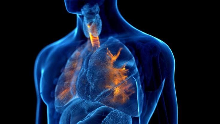 Bpco, la strategia per un migliore accesso alle cure