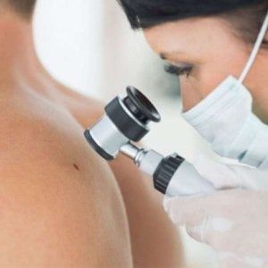 Melanoma, l’immuno-oncologia è efficace in fase “precoce”
