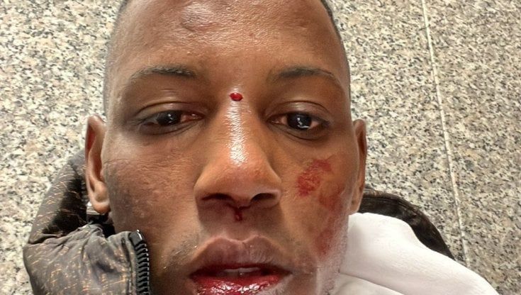 "Mi hanno picchiato senza motivo, ora voglio andare via da Bari": il dolore di Abdul, vittima di una baby gang in stazione
