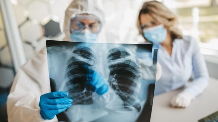 Tante nuove polmoniti in ospedale, ecco chi colpiscono e i batteri atipici