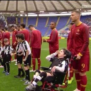 Dzeko e il sorriso di Ilary, un calcio alle discriminazioni