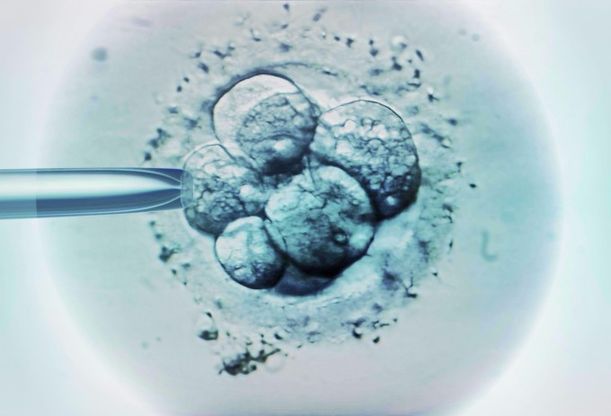 Eterologa, "Accesso dati sanitari donatore, per motivi salute"