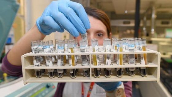 Leucemia mieloide acuta, una cura per le forme più aggressive
