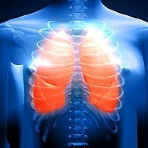 Fibrosi cistica, scienziati italiani alla ricerca del "farmaco risolutivo"