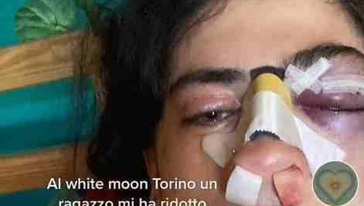 "Pugni alla mia ragazza solo perché indossavo occhiali leopardati"