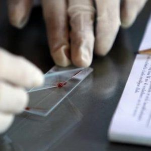 Malaria, come si trasmette e quali sono i sintomi