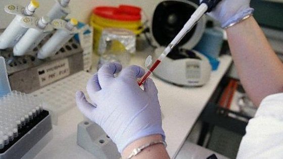 Legionella a Parma: campionamenti Ausl, task force della Regione