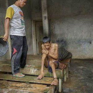 Indonesia, disabili psichici in catene: l’orrore nella pratica del pasung