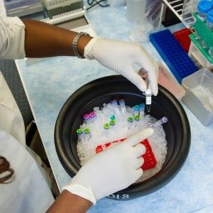 Tumore del pancreas: la terapia target aumenta la sopravvivenza