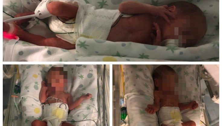 A Bari nascono 3 gemelli, tripla festa al Di Venere: "Benvenuti Rebecca, Alessia e Nathan Francesco"