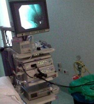 Gastroscopia in tempo reale: "15 secondi per scovare il rischio di tumore"