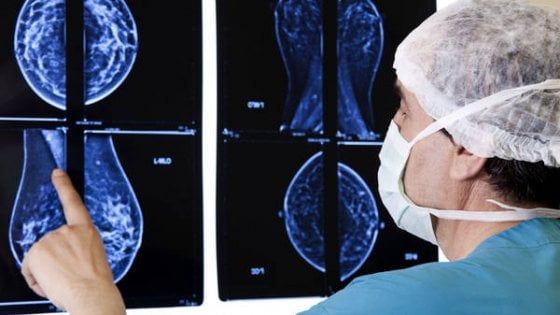 Cancro al seno: ancora troppe donne non aderiscono allo screening