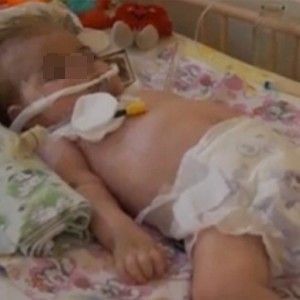 Storia del piccolo Zhenija, nell'ospedale sotto le bombe, conteso tra Russia e Kiev