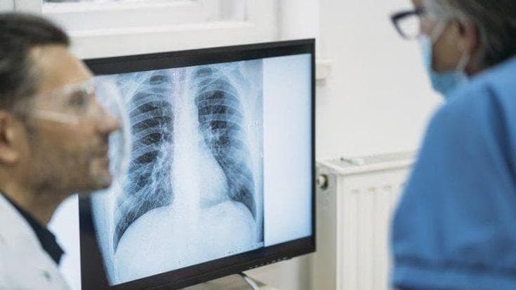 Fibrosi polmonare, un team di specialisti per cure più mirate