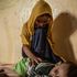 Yemen, la guerra e la mancanza di tutto colpiscono oltre dodici milioni di bambini