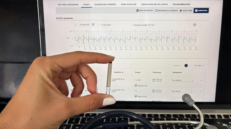 Santobono: ecco il Loop Recorder, salvavita che controlla a distanza i parametri cardiaci dei bimbi