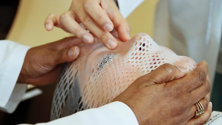 Prevedere i benefici della radioterapia. Grazie al genoma