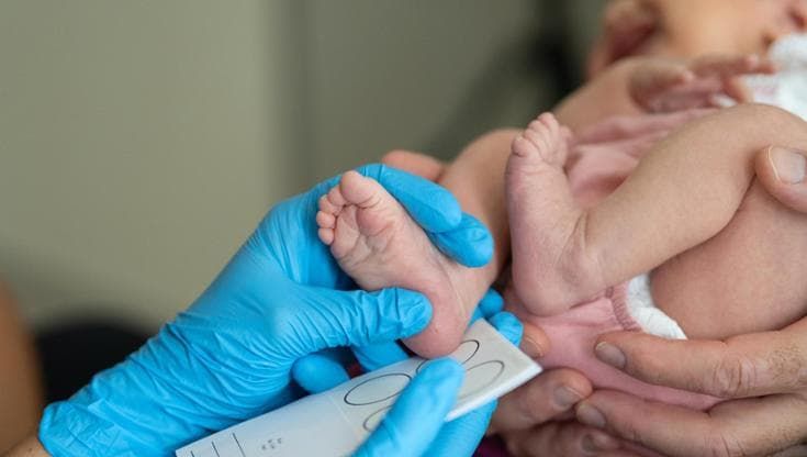 Malattie rare, serve una regia nazionale su screening e genomica