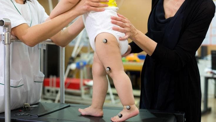 Mattia, il bimbo con gli elettrodi che ha imparato a camminare