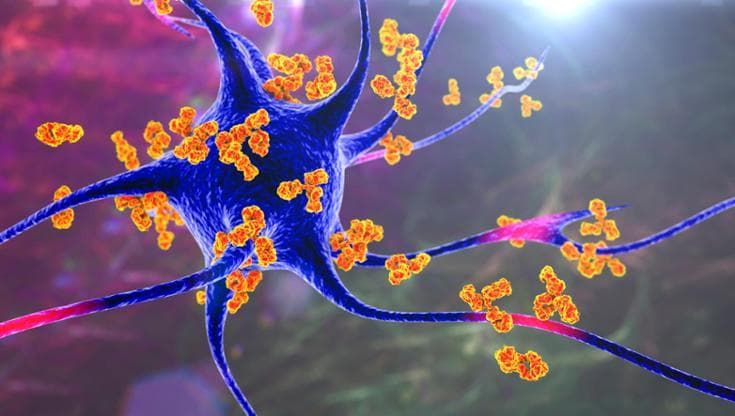 Il trapianto di cellule staminali "azzera" una rara patologia autoimmune