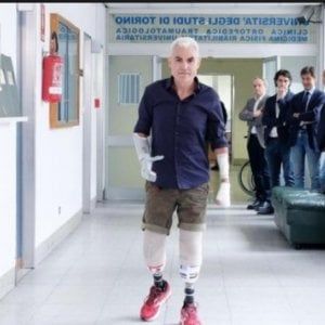 L'ultramaratoneta Zanda torna a guidare grazie alle protesi del Cto di Torino