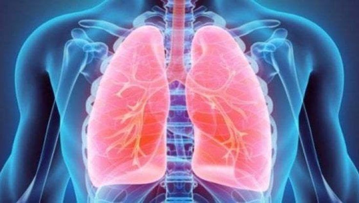 Trapianto del polmone: per la prima volta al mondo utilizzata una protesi