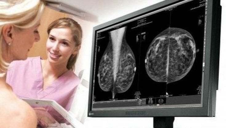 Tumori, invalidità civile e 104: come facilitare il percorso